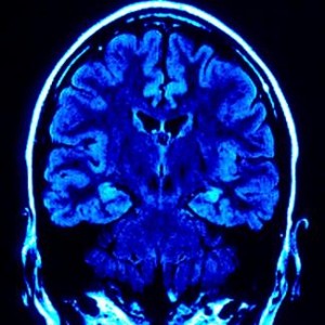 a causa de l'addicció el cervell es transforma